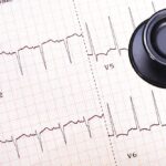 mesterséges intelligencia EKG