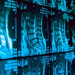 MI képalkotás orvosi diagnosztika