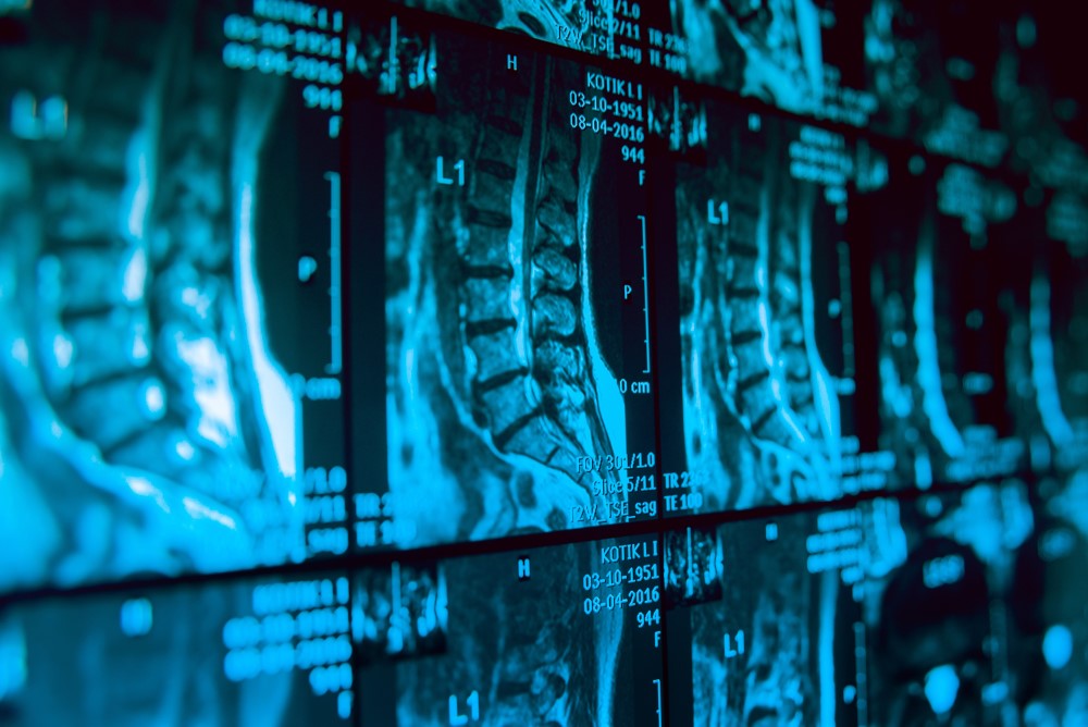 MI képalkotás orvosi diagnosztika