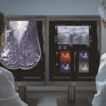 LG monitor orvosi