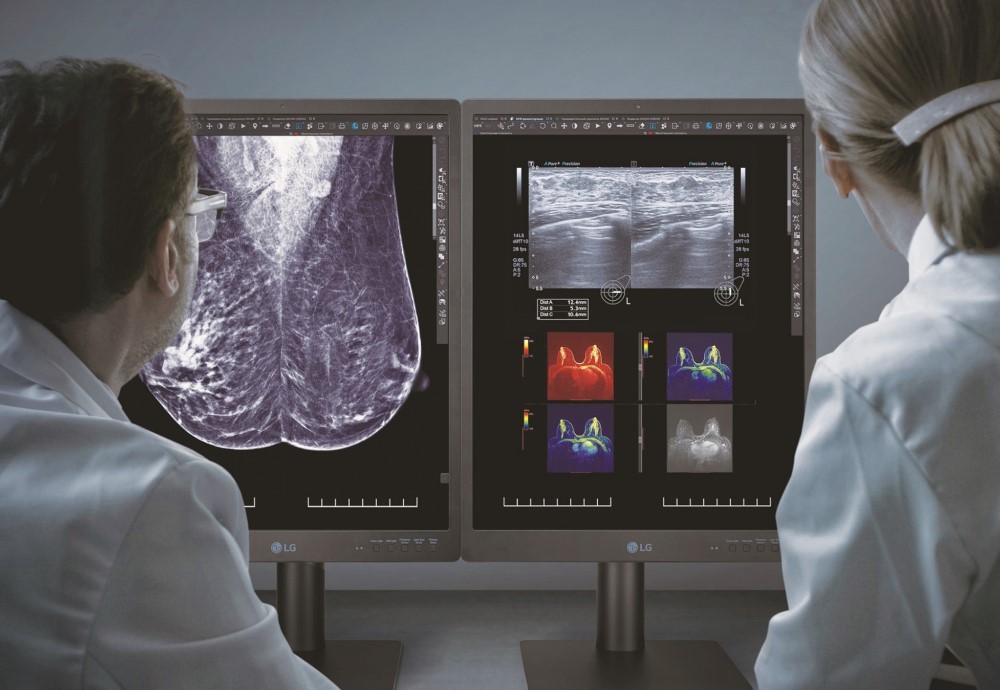 LG monitor orvosi