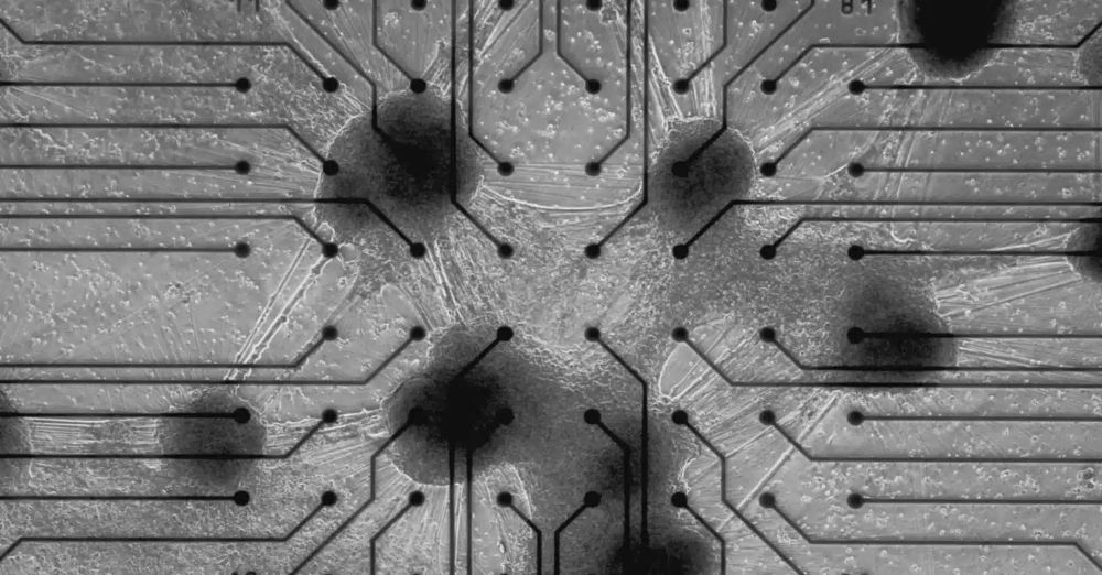 Cortical 03